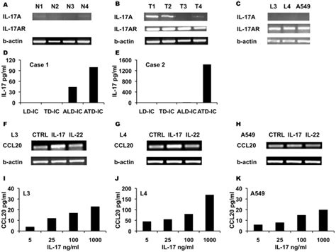 Pcr Signal For Il 17a Il 17a Receptor And B Actin In Nsclc Tissue Download Scientific Diagram