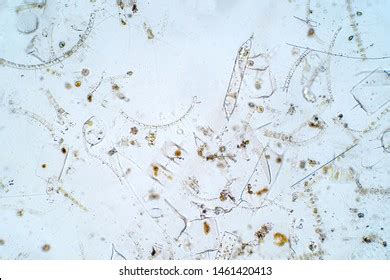 Marine Aquatic Plankton Under Microscope View Stock Photo (Edit Now ...