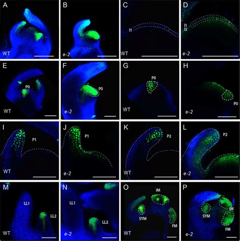 Auxin Signaling In E 2 Mutant Using Dr5venus Rendered Z Stack Of