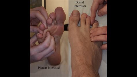 Muscle Palpation Plantar Interossei Dorsal Interossei Pedis Th