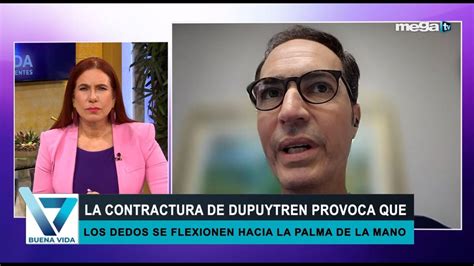 La Contractura De Dupuytren Provoca Que Los Dedos Se Flexionen Hacia La