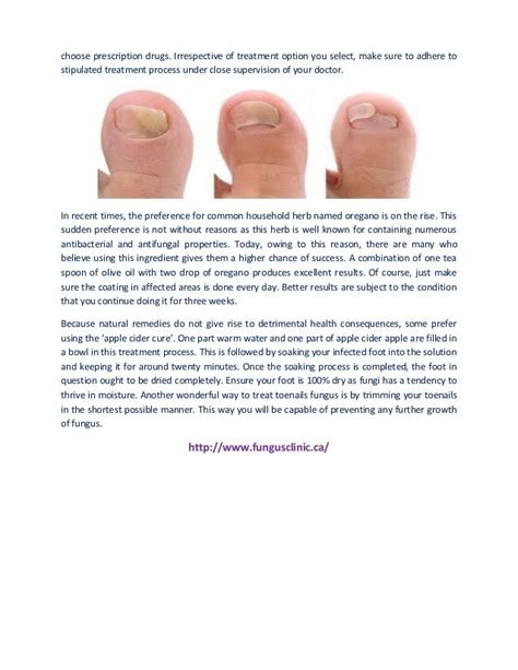 Toenail fungus cure get rid of fungal infection of the toenail