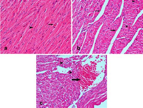 Hematoxylin And Eosin Hande Stained Heart Sections From Mice Treated