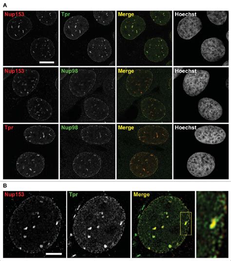 Colocalization Experiments Of Nup Nup And Tpr At The Incs Of