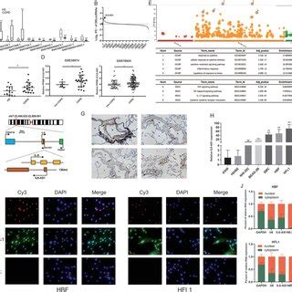 Long Noncoding Rna Lncrna Il As Is Overexpressed In Chronic