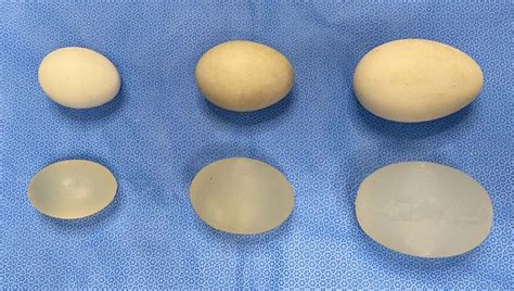 Custom Implant Sizes In Testicular Enhancement The Egg Test Explore Plastic Surgery