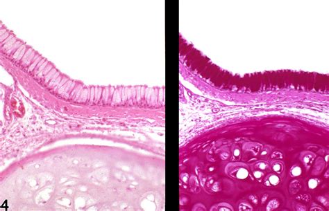 Nose Hyperplasia Goblet Cell Nonneoplastic Lesion Atlas