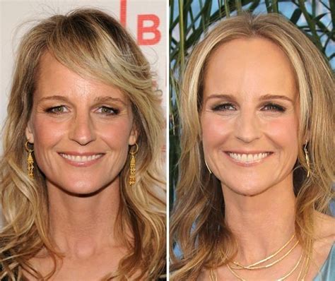 Helen Hunt before and after plastic surgery 02 | Celebrity plastic ...