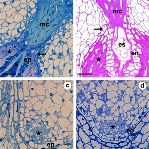 Anatomy of the ovule of T. linearisquameum (a, c) and T. gentile (b,... | Download Scientific ...