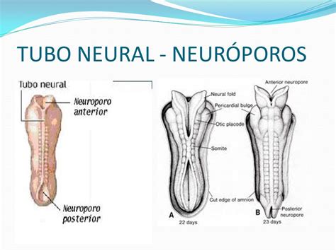 Embriologia Do Sistema Nervoso Ppt Video Online Carregar