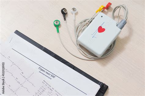 Bicycle Ergometry Electrocardiography, bicycle ergometer stress test ...