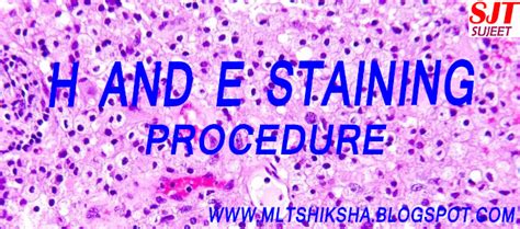 Hematoxylin And Eosin Hande Staining Principle Procedure 43 Off