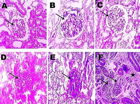 Normal Glomerulus Histology