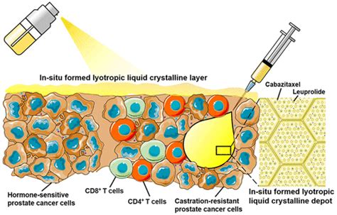 A Clinically Achievable Injectable And Sprayable In Situ Lyotropic Liquid Crystalline Platform