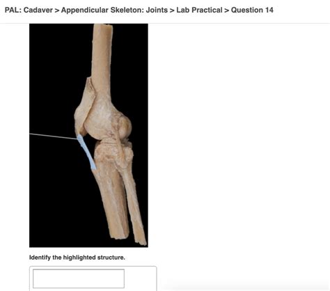 Solved PAL Cadaver Appendicular Skeleton Joints Lab Chegg