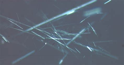 Asbestos Under Microscope - bisnis plastik