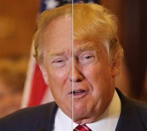 Donald Trump before and after using botox (16) | Celebrity plastic ...