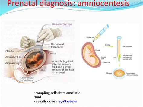 Ppt Karyotype Powerpoint Presentation Free Download Id1905374