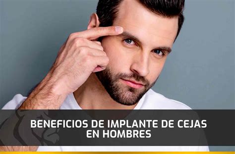 Beneficios De Implante De Cejas En Hombres Capilar Center