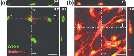 Z Stack Confocal Laser Scanning Micrographs Of HDF Cells Showing