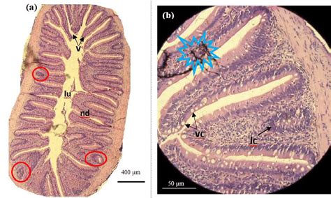 Histology section of fore gut of catla infested with A. japonicus. a)... | Download Scientific ...