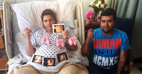 Rare Identical Triplets, Two Conjoined, Born in Texas