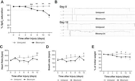 Pulse Oximetry In The Bleomycin Model Of Lung Injury A Dynamics Of