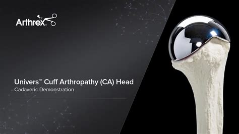 Arthrex Univers Cuff Arthropathy Ca Head Cadaveric Demo