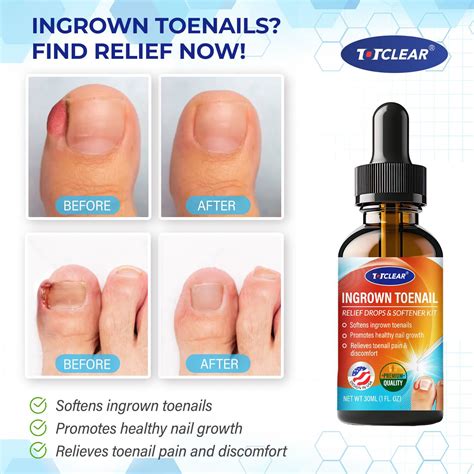 GetUSCart- Ingrown Toenail Relief: Ingrown Toenail Tool for Men Women