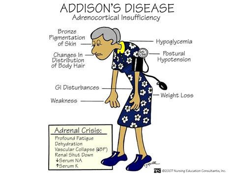 Addison S Disease Nursing Nursing Pinterest