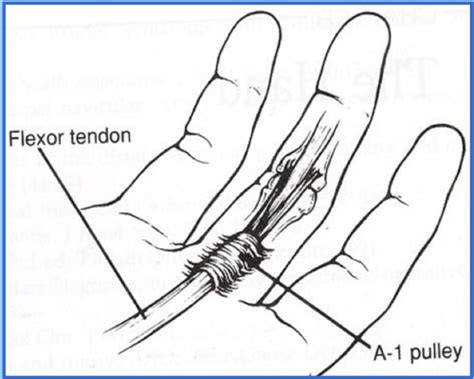 MSC IV Wrist And Hand Anatomy Biomechanics Flashcards Quizlet