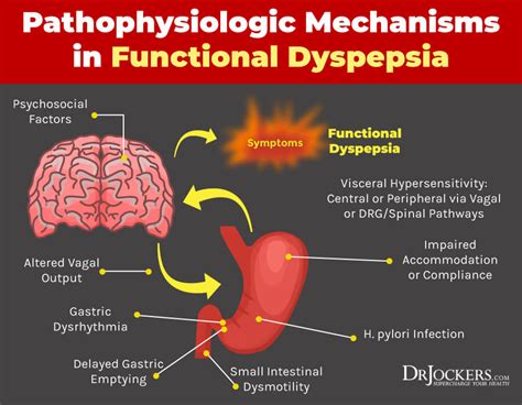 Dyspepsia: 8 Strategies to Improve Indigestion - DrJockers.com