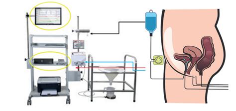 O Que E Estudo Urodinamico - Estudo Urodinâmico: indicações, fases do exame e interpretação dos ...