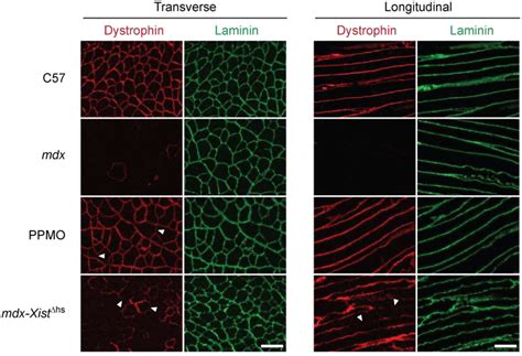 Dystrophin Protein Localization In Peptidephosphorodiamidate