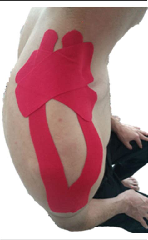 [pdf] The Short Term And Long Term Effects Of Kinesio Taping On The