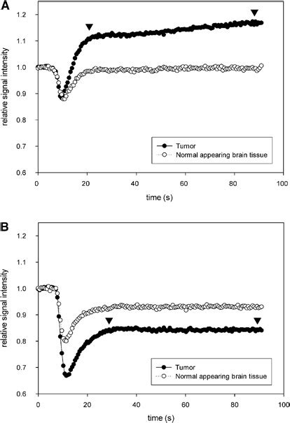 First Pass Time Intensity Curves Of Perfusion A When Intravenous