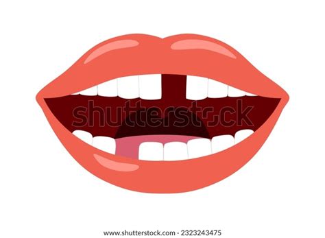 Human Teeth Missing Teeth Photos and Images | Shutterstock