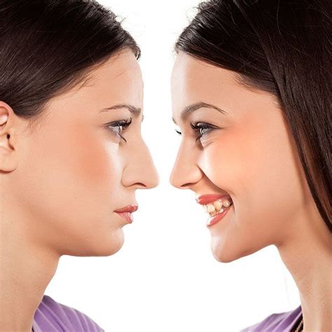 The Ultimate Guide To Houston Rhinoplasty Avante Plastic Surgery