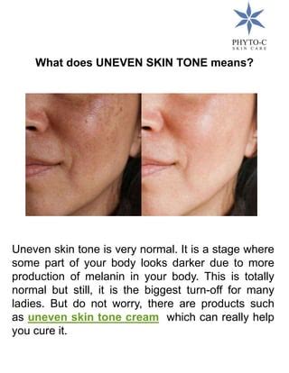 What does UNEVEN SKIN TONE means? | PDF