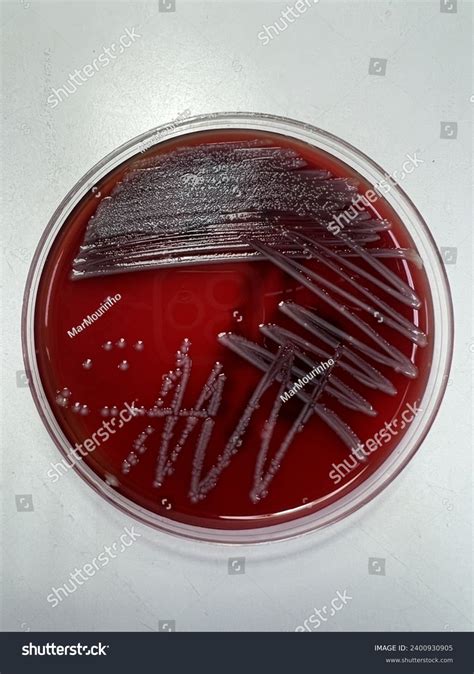 Klebsiella Oxytoca On Blood Agar Stock Photo 2400930905 Shutterstock