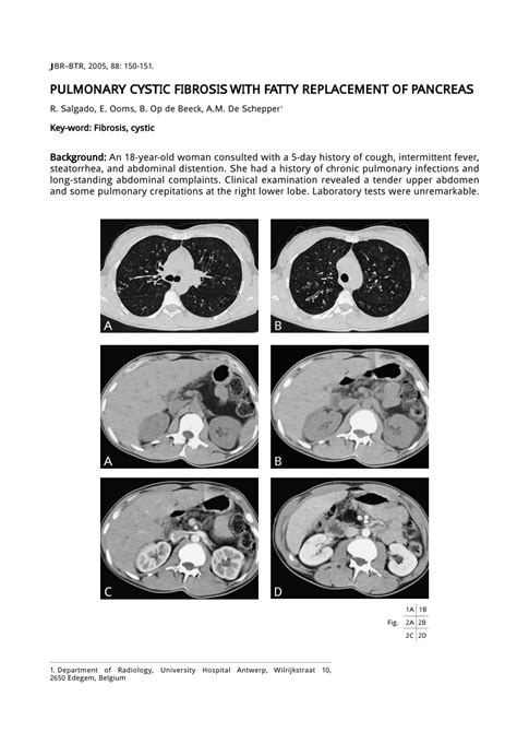 PDF Pulmonary Cystic Fibrosis With Fatty Replacement Of Pancreas