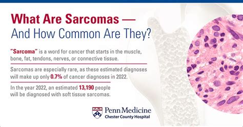 How Much Do You Know About Sarcoma Chester County Hospital Penn