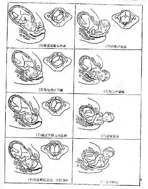 图50 枕左前位分娩机转示意图