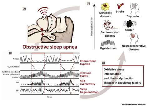 Obstructive Sleep Apnea And Hallmarks Of Aging Trends In Molecular