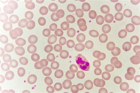 Neutrophil cell stock photo. Image of blood, laboratory - 112054540