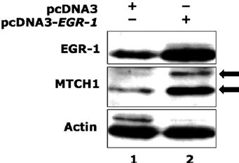 Effects Of Doxorubicin And RNA Interference On The Levels Of EGR 1 And