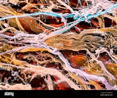 Connective Tissue False Colour Scanning Electron Micrograph Sem Of