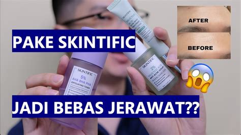 Review Skintific Acne Series Bikin Bebas Jerawat Exfoliating Toner Serum Spot Treatment