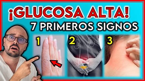 7 SeÑales Reveladoras De Una Diabetes Irreversible ¡signos De Glucosa Alta Youtube