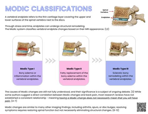 Demystifying Modic Changes - Your Ultimate 5-minute Guide — ChiroUp
